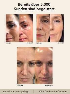 Botox-Like Peptide Serum